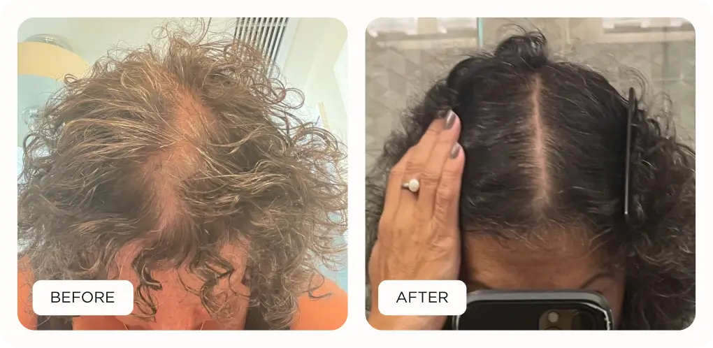 before and after results of Noor product