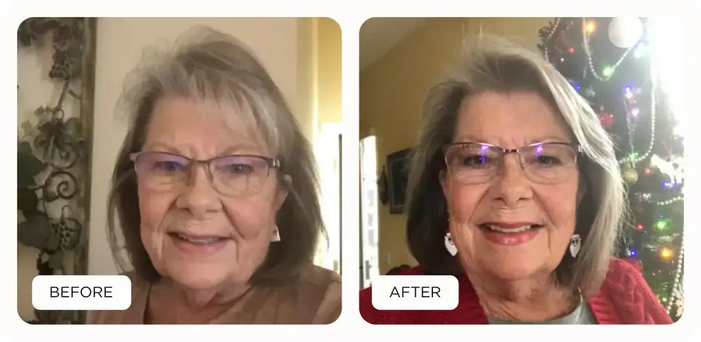before and after results of Noor product