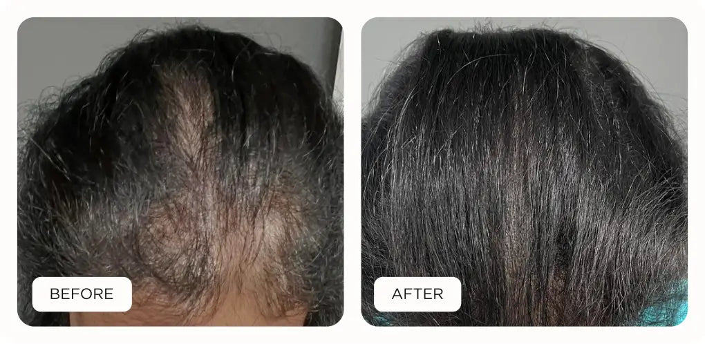 before and after results of Noor product