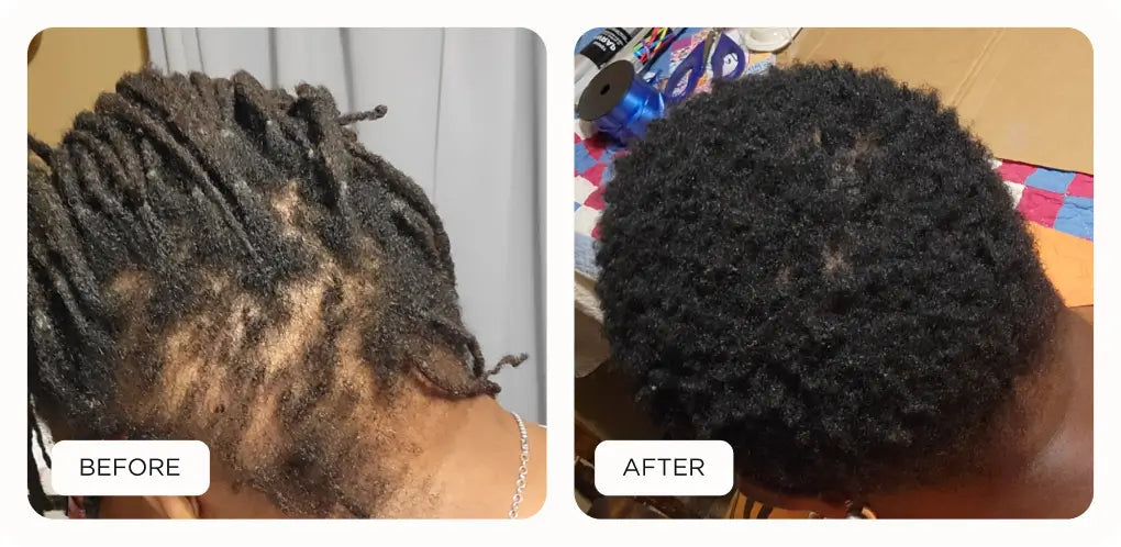 before and after results of Noor product