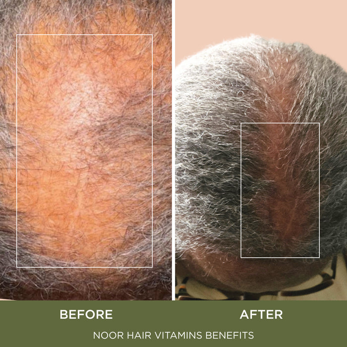 Healthy Hair Formula Lower