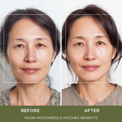Advanced K-Beauty Microneedle Combo Mask