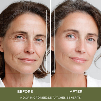 Advanced K-Beauty Microneedle Combo Mask