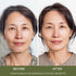 Advanced K-Beauty Microneedle Combo Mask