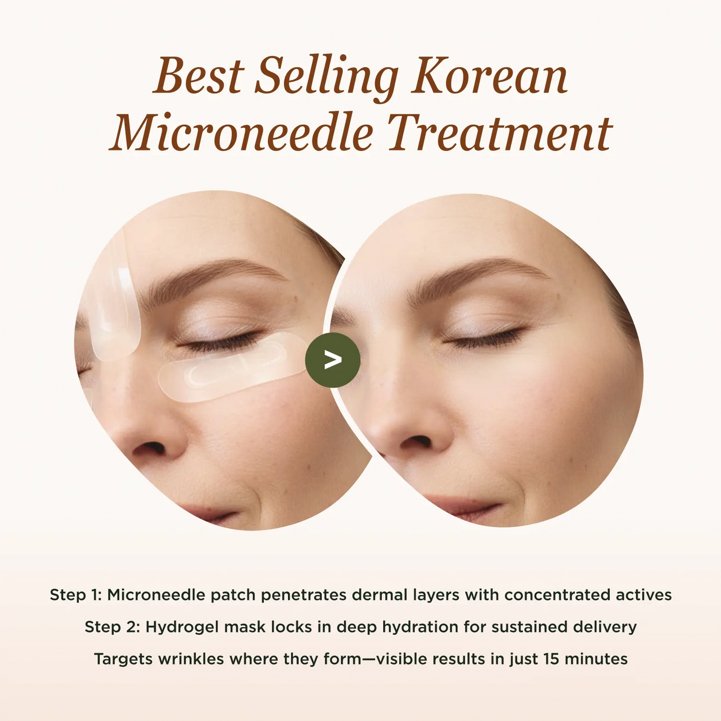 Advanced K-Beauty Microneedle Combo Mask