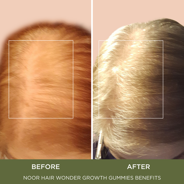 Wonder Growth Gummies