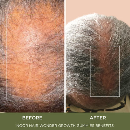 Wonder Growth Gummies