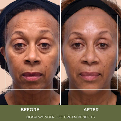 WonderLift Cream