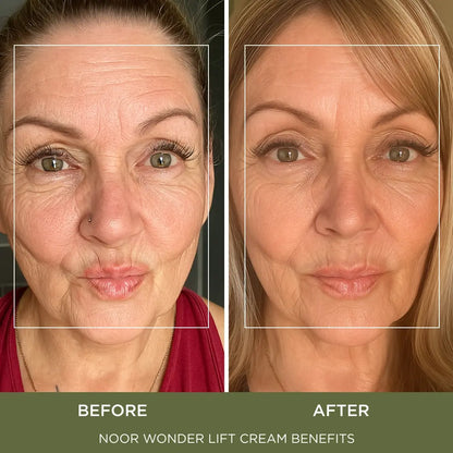 WonderLift Cream