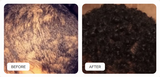 before and after results of Noor product